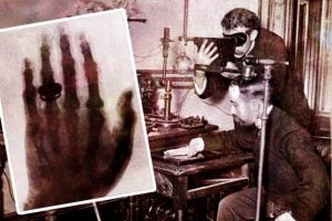 How X-rays were first discovered